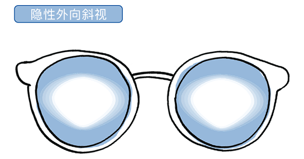 Puyi Optical_Myopia Management_11