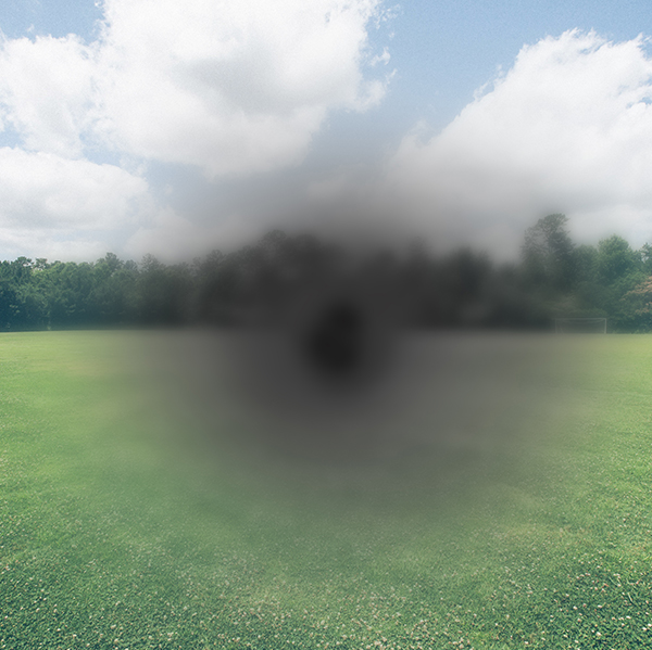 MACULAR DEGENERATIONh