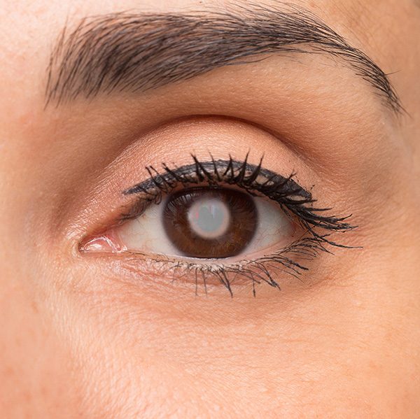 CATARACT